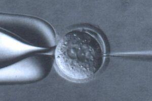 core image